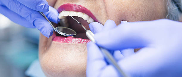 Best Broken or Chipped Tooth Repair in Phoenix, NY
